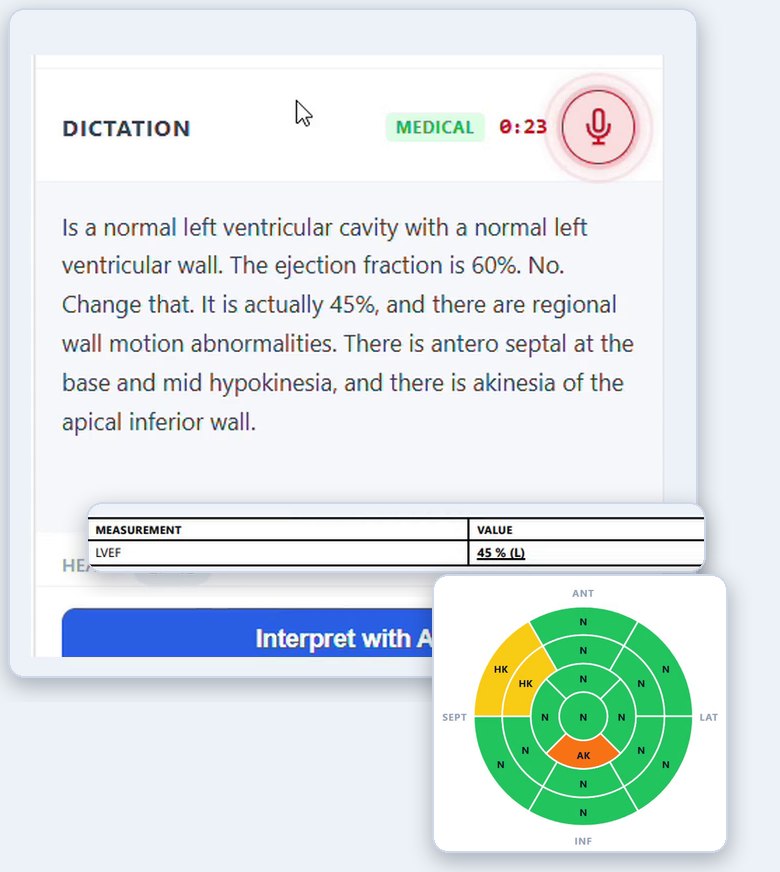 Three parts of the EchoAI workflow layered together. Behind: the dictation panel mid-recording, its transcript reading that the ejection fraction is 60%, no, change that, it is actually 45%, with regional wall motion abnormalities. Over it: a report row giving LVEF a value of 45% against a normal range of 52 to 72 for men and 54 to 74 for women. And a 17-segment bullseye map with two hypokinetic segments and one akinetic segment marked.